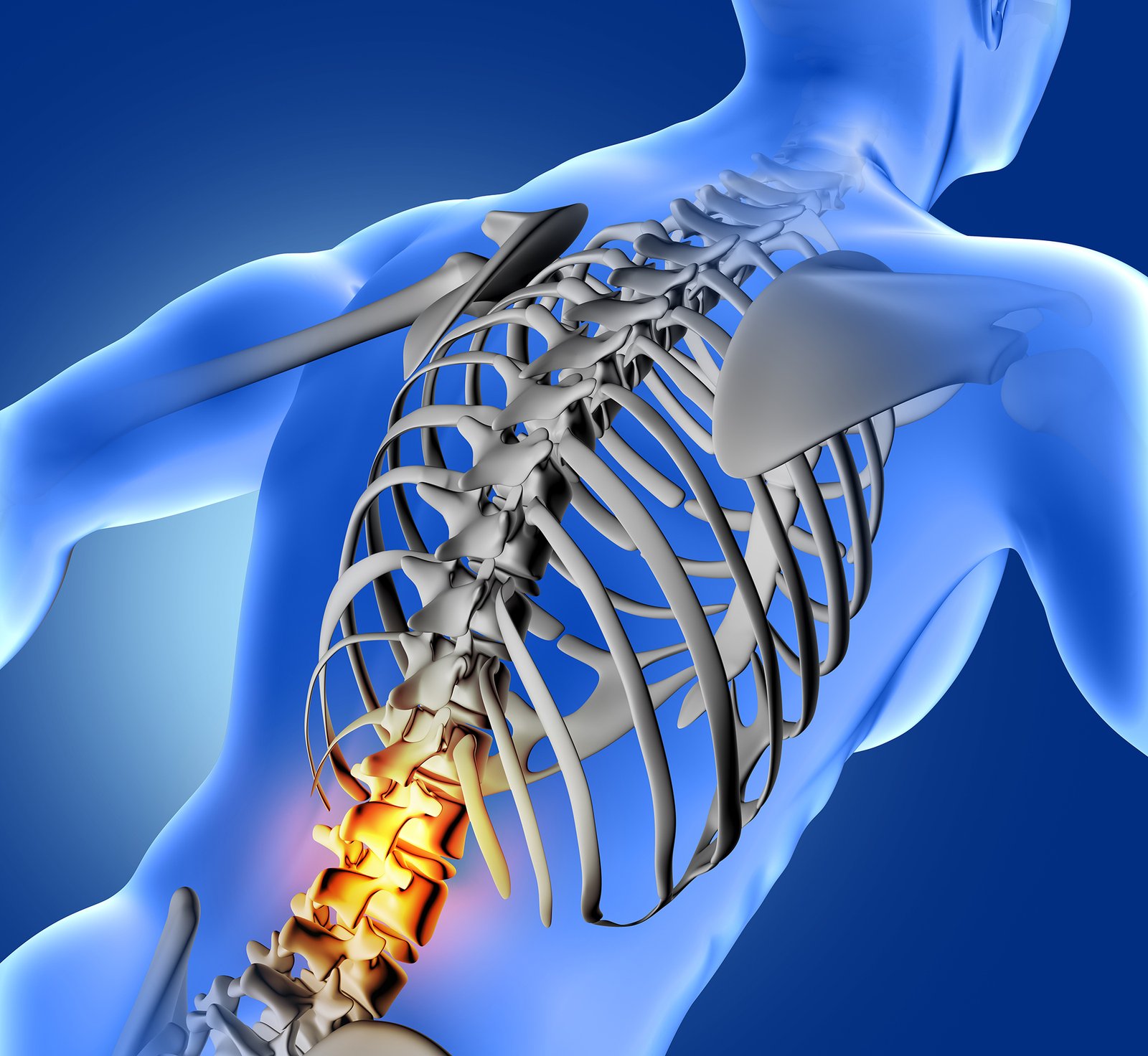 Back Pain Treatment in Bangalore