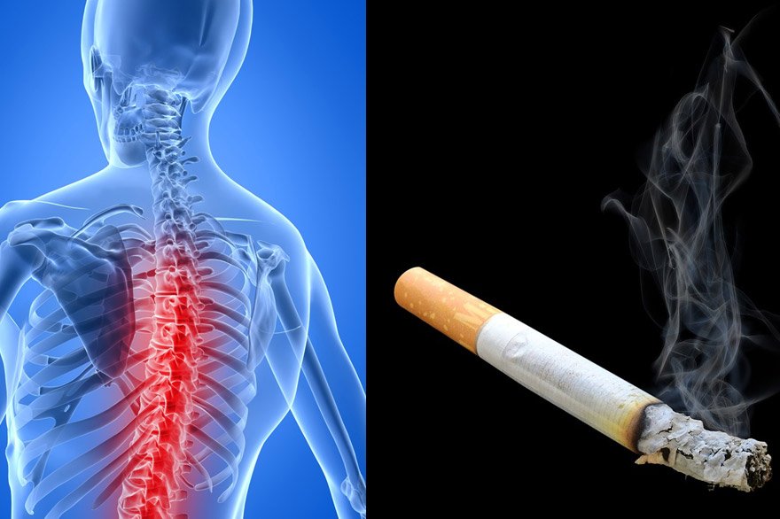 Smoking spine banner