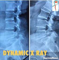 Dynamic X Ray