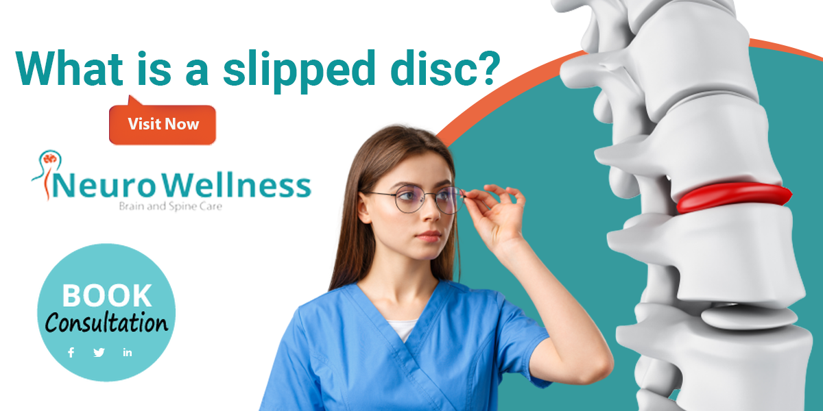 slipped disc