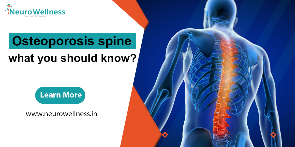 Osteoporosis spine: – what you should know?